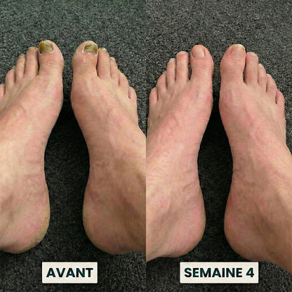 Formule de soin des ongles Mucoor